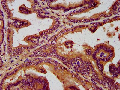 SLC19A2 Antibody