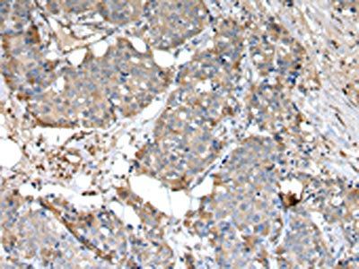 SLC1A1 Antibody