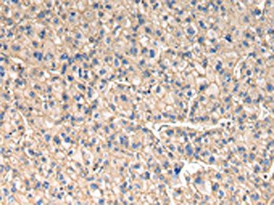 SLC1A1 Antibody
