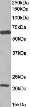 EAAT1/GLAST1 (aa197-208) Antibody