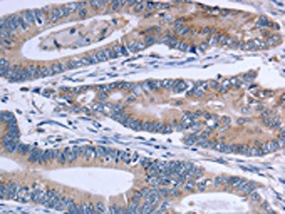 SLC1A6 Antibody