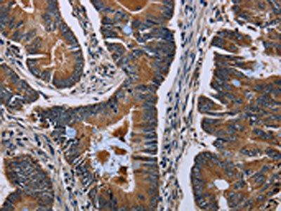 SLC1A6 Antibody
