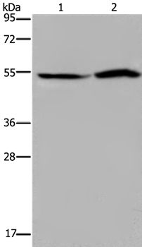 SLC22A12 Rabbit Polyclonal Antibody