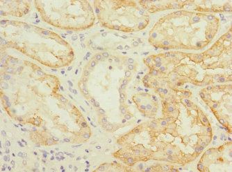 SLC22A8 Antibody