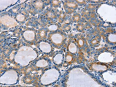 SLC25A1 Antibody