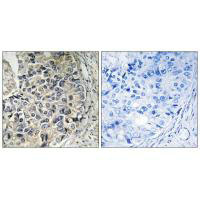 SLC25A12 Antibody