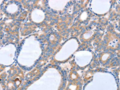SLC25A13 Antibody