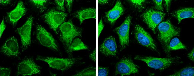 solute carrier family 25 member 13 Antibody