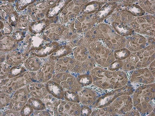 solute carrier family 25 member 13 Antibody