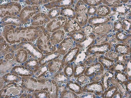 solute carrier family 25 member 13 Antibody