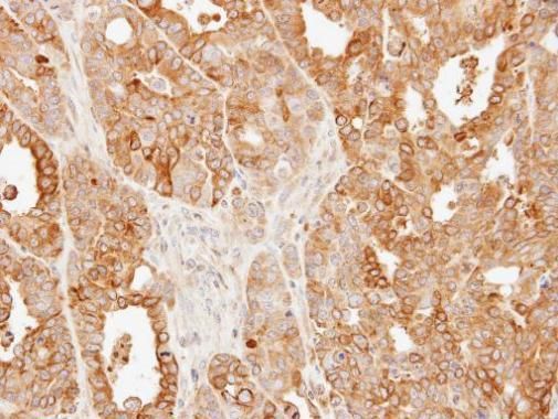 solute carrier family 25 member 13 Antibody