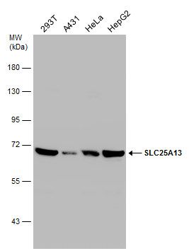 solute carrier family 25 member 13 Antibody