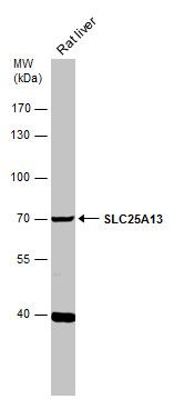 solute carrier family 25 member 13 Antibody
