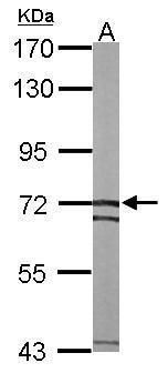 solute carrier family 25 member 13 Antibody