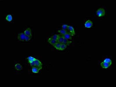 SLC25A38 Antibody
