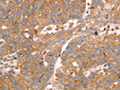SLC25A38 Antibody