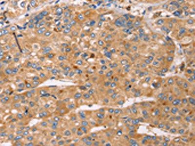 SLC25A38 Antibody