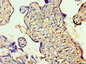 SLC27A4 Antibody