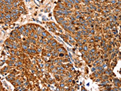 SLC27A5 Antibody