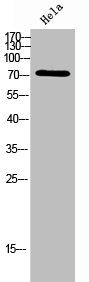 SLC27A5 Antibody
