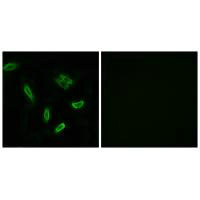 SLC27A5 Antibody