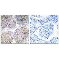 SLC27A5 Antibody