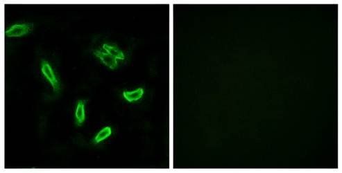 SLC27A5 Antibody