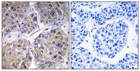 SLC27A5 Antibody