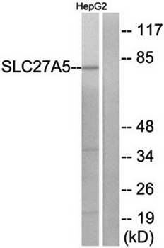 SLC27A5 Antibody