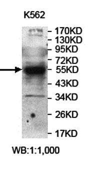 SLC29A1 Rabbit Polyclonal Antibody