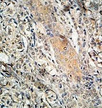 SLC29A1 Rabbit Polyclonal Antibody