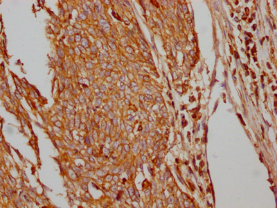 SLC2A1 Antibody