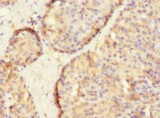 SLC2A13 Antibody
