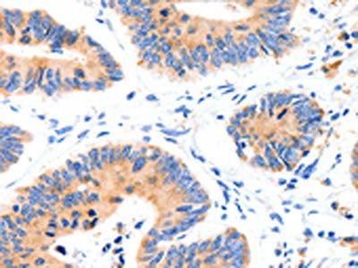 SLC2A4 Antibody