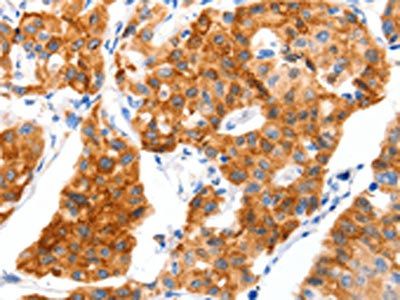 SLC2A4 Antibody