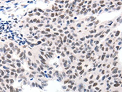 SLC2A4 Antibody
