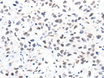 SLC2A4 Antibody