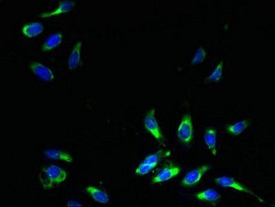 SLC31A2 Antibody