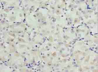 SLC31A2 Antibody