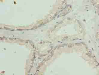 SLC31A2 Antibody