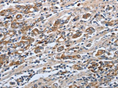 SLC34A2 Antibody