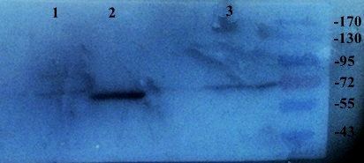 SLC34A2 antibody