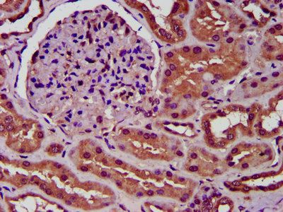 SLC34A3 Antibody