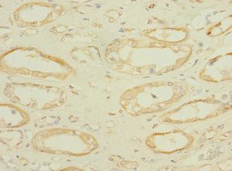 SLC36A2 Antibody
