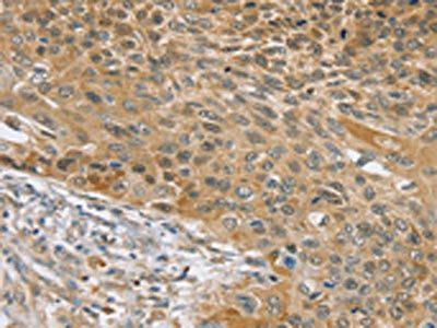 SLC39A3 Antibody