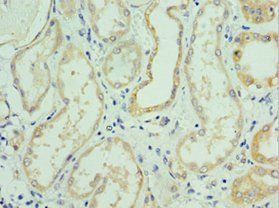 SLC39A6 Antibody