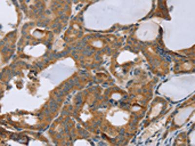 SLC39A7 Antibody
