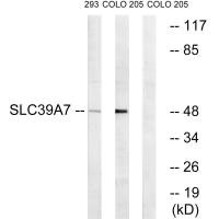 SLC39A7 Antibody