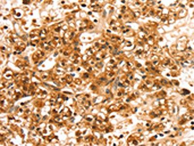SLC44A2 Antibody