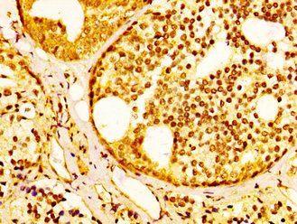 SLC45A3 Antibody
